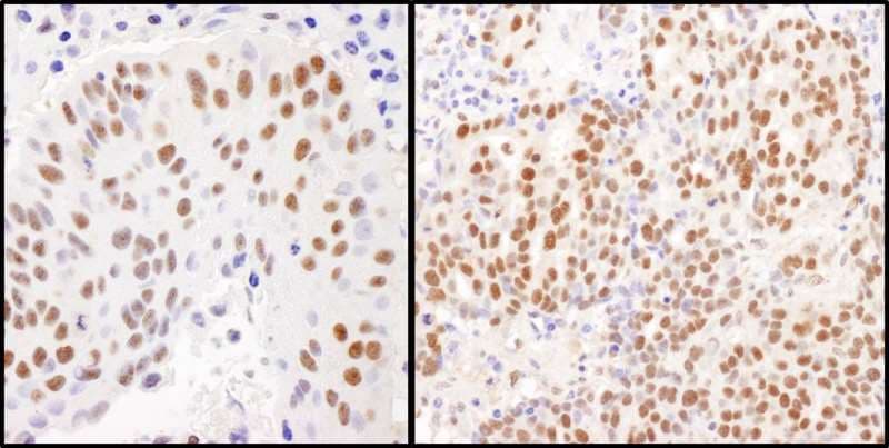 Polyclonal Rabbit anti-Human TRIM28 / KAP1 Antibody (aa650-700, IHC, WB)