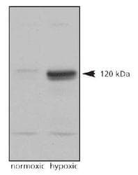 HIF2A / EPAS1 Antibody (C-Terminus, DY488)