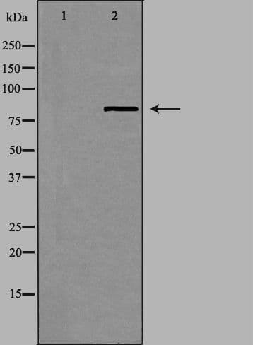 Polyclonal Rabbit anti-Human UTP14A Antibody (IF, WB)