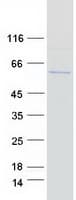 Human ISG54 / IFIT2 Protein (Recombinant Myc-DDK (Flag))