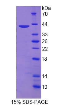 Human NR4A2 / NURR1 Protein (Recombinant His, N-Terminal)