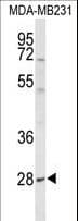 Polyclonal Rabbit anti-Human YIPF5 Antibody (aa21-49, IHC, WB)