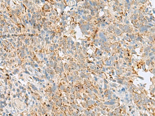 Polyclonal Rabbit anti-Human VDAC3 Antibody (IHC, WB)