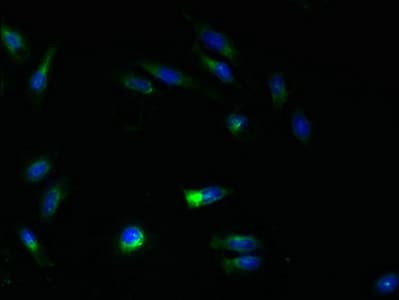 Polyclonal Rabbit anti-Human ATL3 Antibody (IHC, WB)