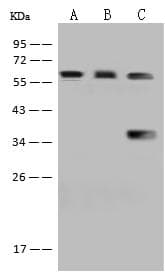 Polyclonal Rabbit anti-Human PCCB Antibody (IHC, WB)