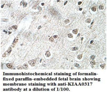 AREL1 / KIAA0317 Antibody (aa551-729)