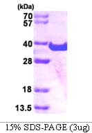 Human SPG21 / MAST Protein (Recombinant His)