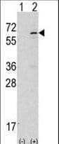 TNK2 / ACK1 Antibody (aa934-964)