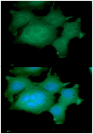 ADRM1 Antibody (clone AT34C2)