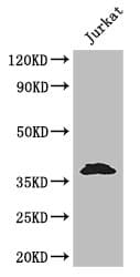 MCL1 / MCL 1 Antibody