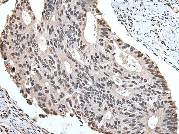 ZBTB10 Antibody