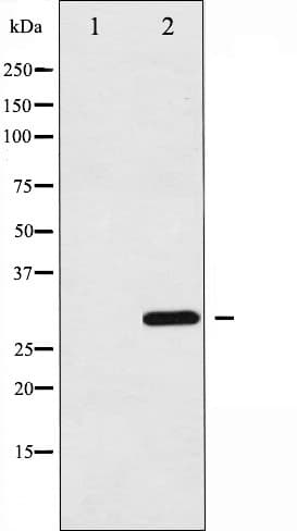 C/EBP Alpha / CEBPA Antibody