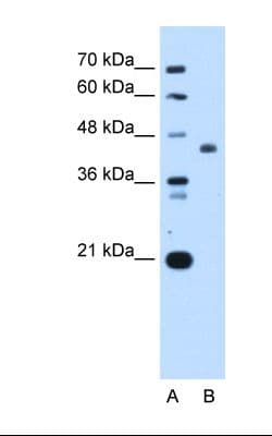 Polyclonal Rabbit anti-Human ST3GAL4 / ST3Gal IV Antibody (aa171-220, IHC, WB)