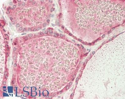 IHC-plus™ Polyclonal Rabbit anti-Human CALR / Calreticulin Antibody (aa 18-417, IHC, WB)