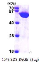 Human HARS Protein (Recombinant His)