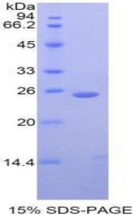 Rhesus monkey CTSK / Cathepsin K Protein (Recombinant His)