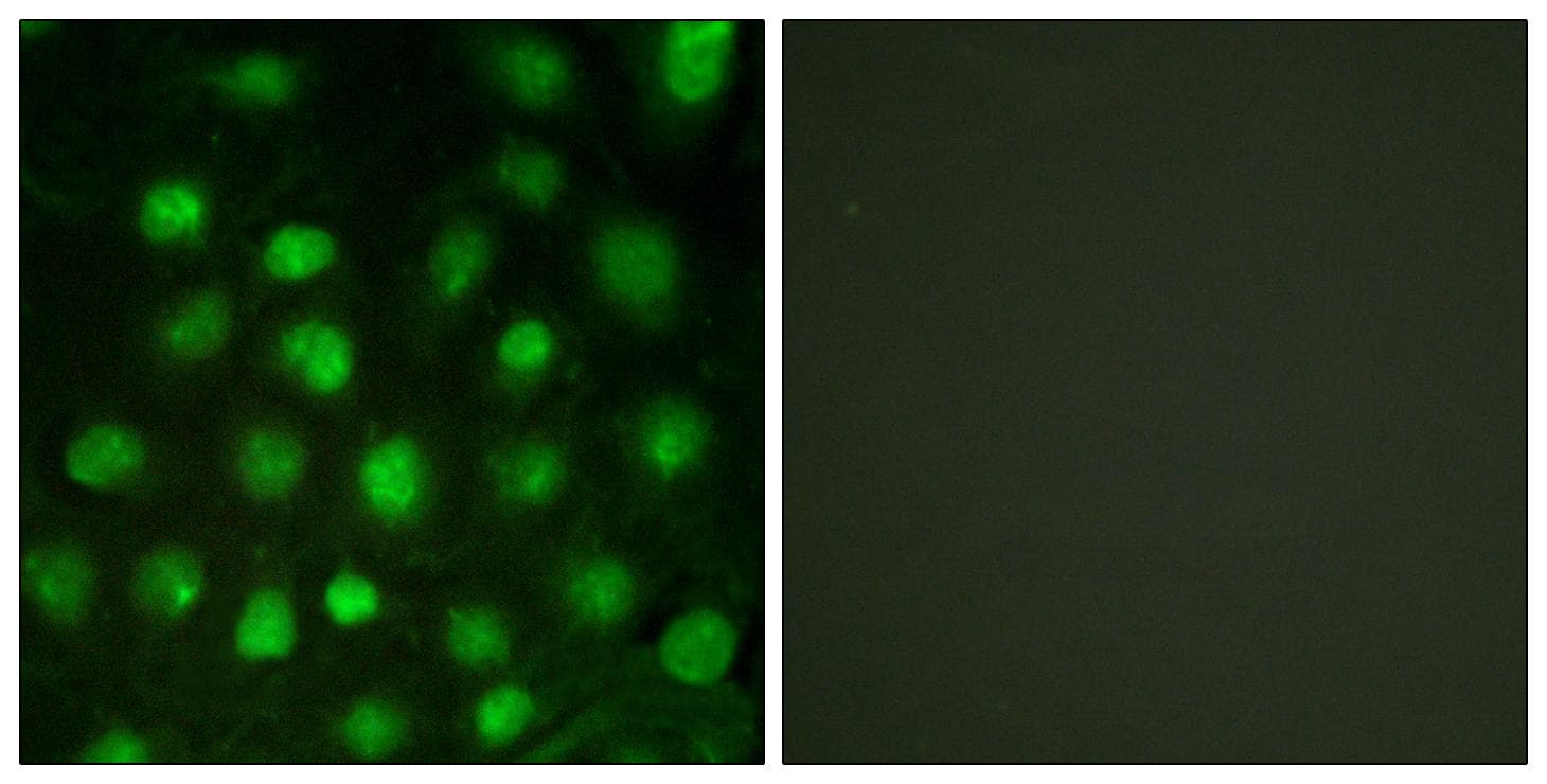 PRKDC / DNA-PKcs Antibody (phospho-Thr2647)