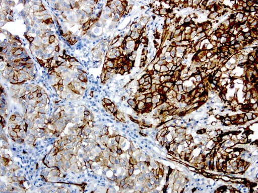 MCAM / CD146 Antibody (clone UMAB155)