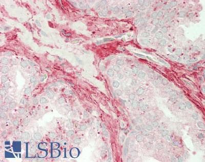 IHC-plus™ DCN / Decorin Antibody (aa 20-359)