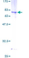 Human B3GNT5 Protein (Recombinant GST)