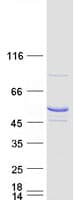 Human TRMT11 Protein (Recombinant Myc-DDK (Flag))
