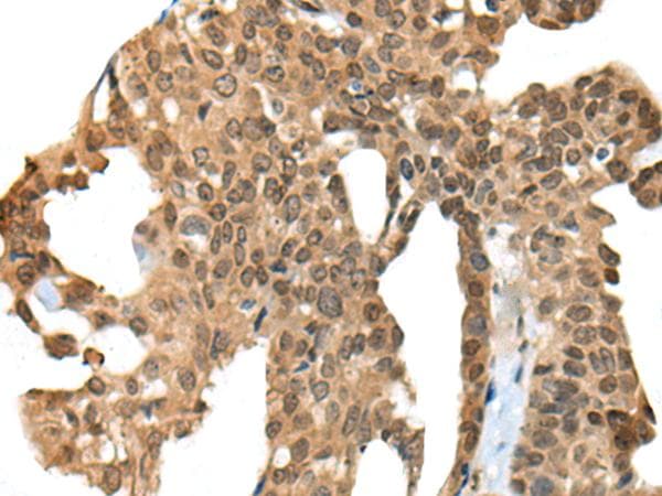 Polyclonal Rabbit anti-Human APC Antibody (IHC)