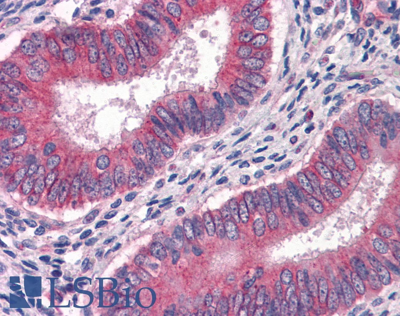 IHC-plus™ GBP1 Antibody (clone 4D10)