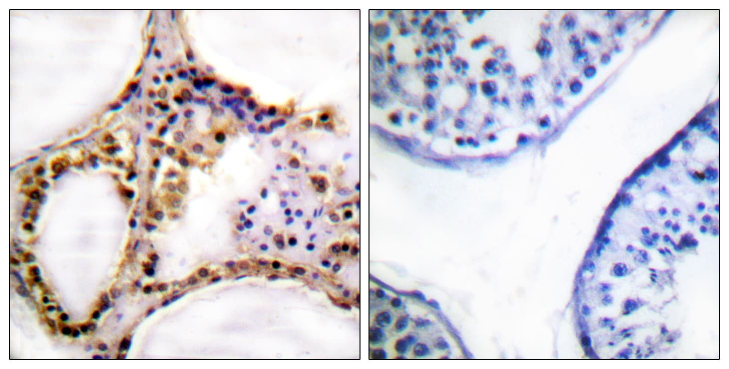 RAD52 Antibody (phospho-Tyr104)