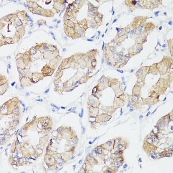Polyclonal Rabbit anti-Human CTNNB1 / Beta Catenin Antibody (IHC, WB)