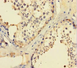 CCDC36 Antibody (aa11-592)