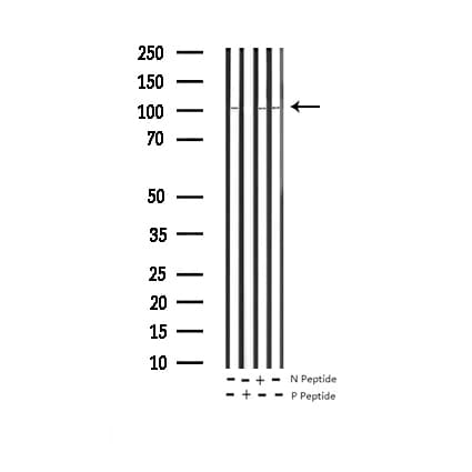 PRKD1 / PKC Mu Antibody (phospho-Ser738,pSer742)