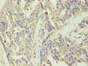 Polyclonal Rabbit anti-Human BCKDK Antibody (aa153-412, IHC, WB)