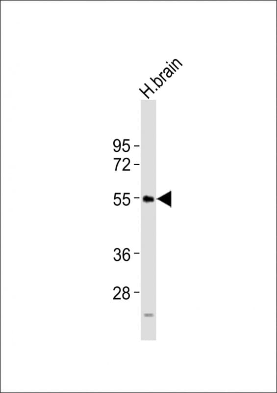 Polyclonal Rabbit anti-Human NPY5R Antibody (aa305-341, WB)