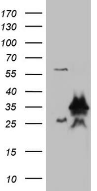 Monoclonal Mouse anti-Human LGALS3 / Galectin 3 Antibody (clone OTI2F1, Carrier-free, IHC, WB)