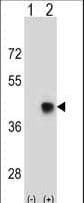 Polyclonal Rabbit anti-Human SPEM1 Antibody (aa115-143, WB)