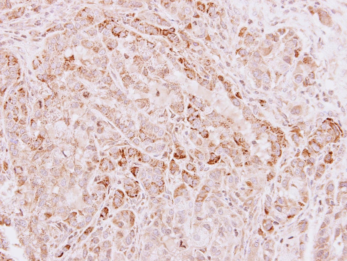 Polyclonal Rabbit anti-Human GLDC Antibody (aa442-723, IHC, WB)
