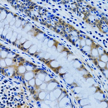 Polyclonal Rabbit anti-Human IMPA1 / IMP Antibody (IHC, IF, WB)