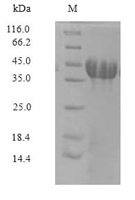 Rat Amigo3 Protein (Recombinant 6His, N-terminus)