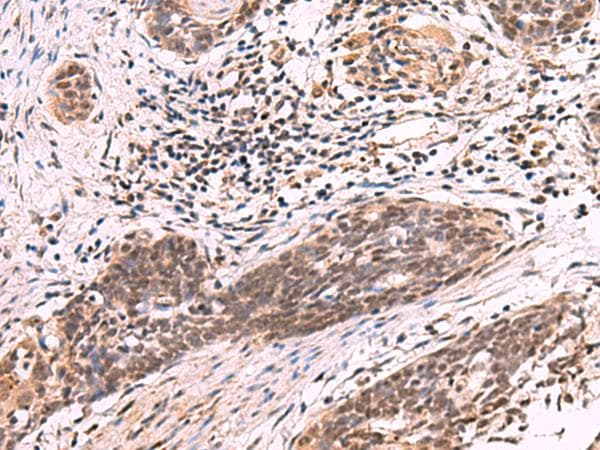 ARIH2 Antibody