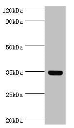 ARG1 / Arginase 1 Antibody (aa1-322)