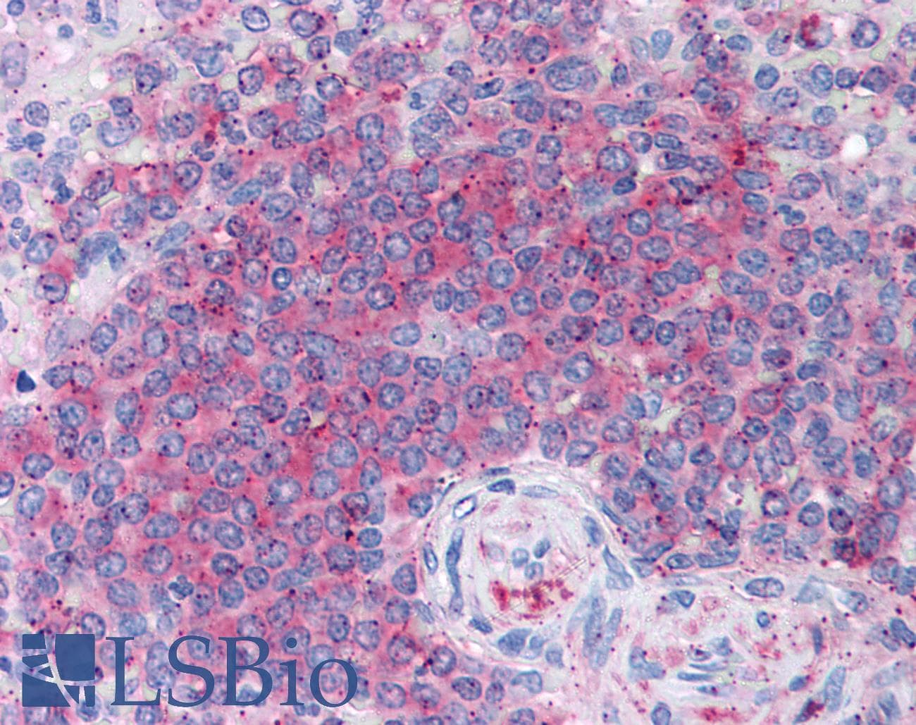 IHC-plus™ AICAR / ATIC Antibody (clone F38 P7 H9)