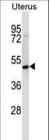ATOH8 Antibody (aa10-39)