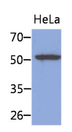 IHC-plus™ KRT8 / CK8 / Cytokeratin 8 Antibody (clone AT3D11)