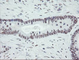 ZBED1 / TRAMP Antibody (clone OTI2A7)