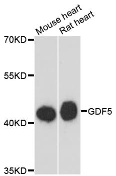 GDF5 / GDF-5 Antibody