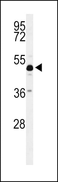 IHC-plus™ Polyclonal Rabbit anti-Human ANKH Antibody (aa464-492, IHC, WB)