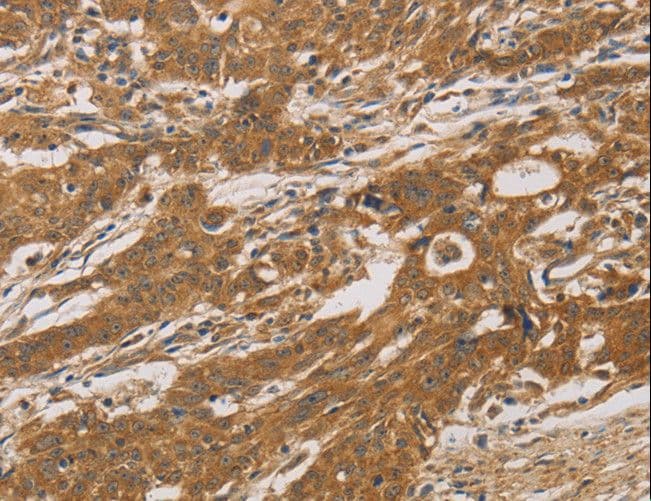 CYP17 / CYP17A1 Antibody