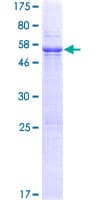 Human TEX101 Protein (Recombinant GST)