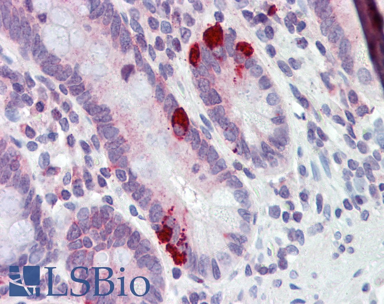 Polyclonal Rabbit anti-Human SLC39A5 / ZIP5 Antibody (aa38-87, IHC, WB)