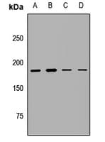 KMT2A / MLL Antibody